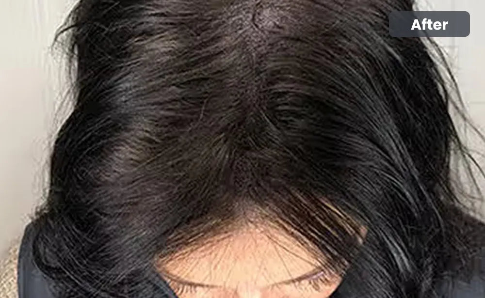 After
