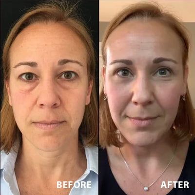 EyeRenew Pro