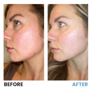 3-in-1 LED Skin Sculptor